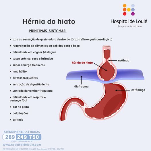 Já ouviu falar em hérnia do hiato?