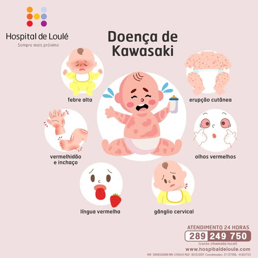 Doença de Kawasaki