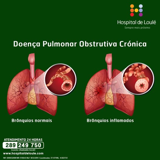 Chronic Obstructive Pulmonary Disease