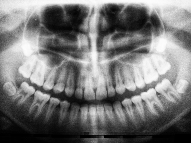 Digital Orthopantomography